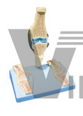 The model of rheumatic knee joint